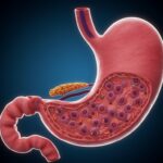 Understanding the Role of HCl in Stomach During Protein Digestion